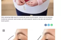 tikali-burun-kilo-vermeye-engel-oluyor-1-scaled